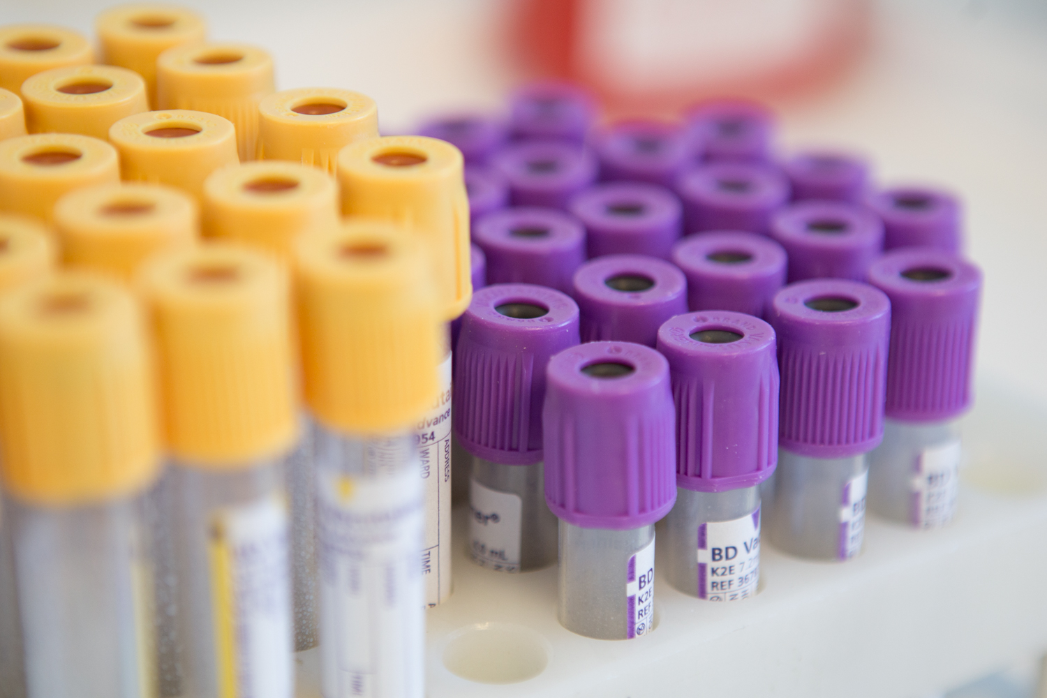 Test tubes